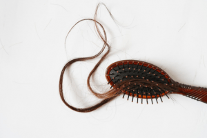 Hair loss
